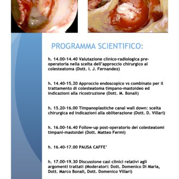 Webinar sul management del colesteatoma